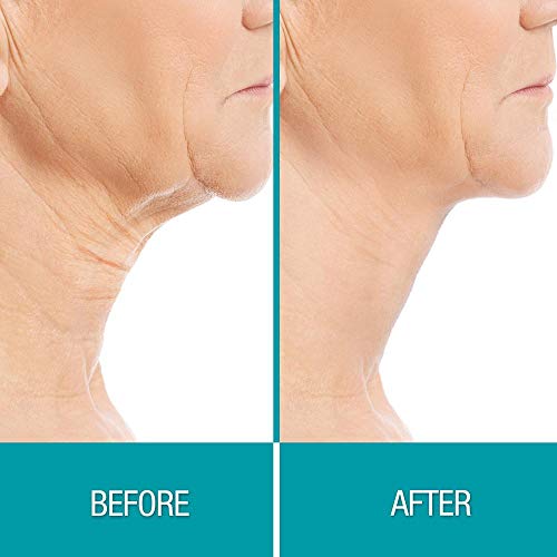 Стягане на колаген маска за брадичката Dermactin-TS Crepe Be Gone Skin .пакетет 35 грама (2 ОПАКОВКИ)